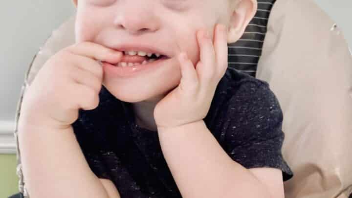 Can Animals Have Down Syndrome? What Science Actually Says